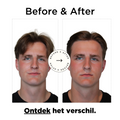 Haar Clay Before After